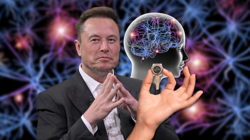 Elon Musk Is Looking For Volunteers To Trial His New Brain Implant