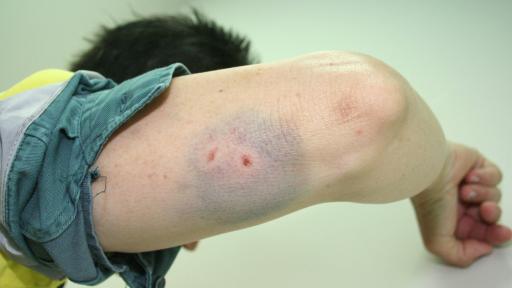 Qld Energex crews face rising threats from dogs and people