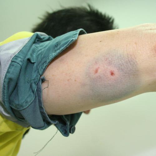 Qld Energex crews face rising threats from dogs and people