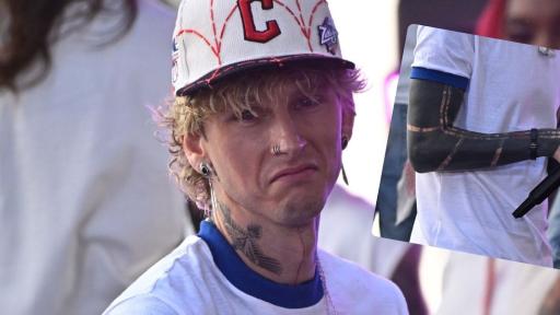 When “Dark Mode” Goes Wrong: MGK’s Brutal Blackout Tattoo Side Effects