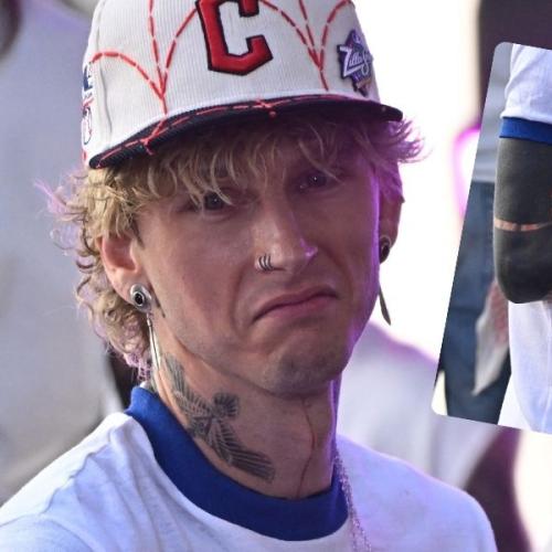 When “Dark Mode” Goes Wrong: MGK’s Brutal Blackout Tattoo Side Effects